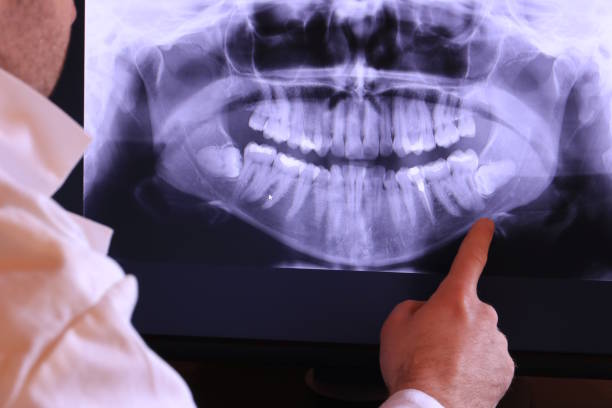 Best Emergency Dental Care for Abscessed Tooth in Parklawn, CA