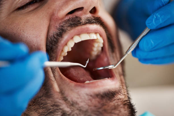 Best Emergency Dental Services for Seniors in Parklawn, CA