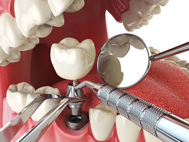 Best Emergency Dentist for Special Needs Patients in Parklawn, CA